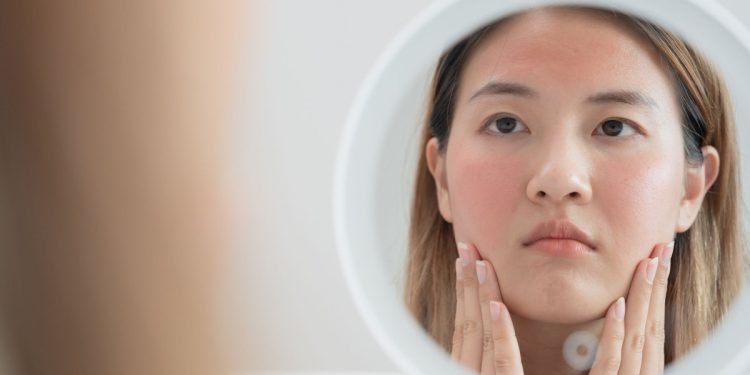 Εξανθήματα-στο-σώμα:-Τι-θα-προσέξετε-αν-κάτι-σοβαρό-συμβαίνει