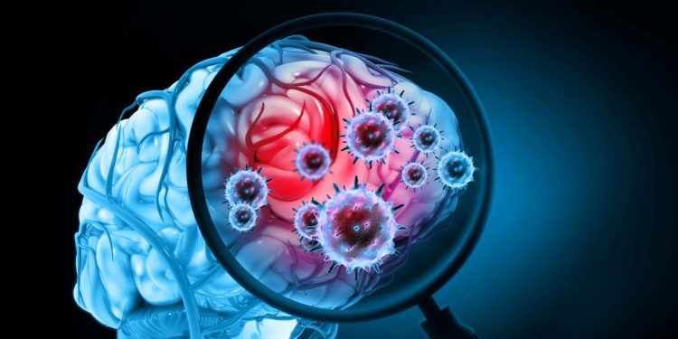 Μηνιγγίτιδα:-Ποια-είναι-τα-συμπτώματα-και-οι-επιπλοκές-–-Πότε-θεωρείται-επείγουσα-κατάσταση