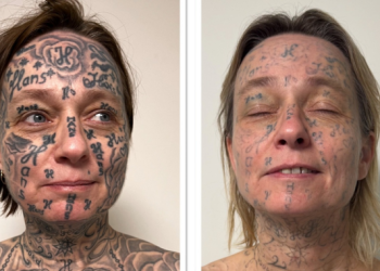 Απίστευτη-κακοποίηση-στην-Ολλανδία:-Έκανε-τατουάζ-250-φορές-το-όνομά-του-στο-κορμί-της-κοπέλας-του!