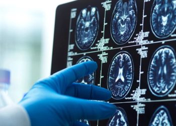 Άνοια:-Ανθυγιεινή-διατροφή,-καθιστική-ζωή-και-λιγότερη-αισιοδοξία-σχετίζονται-με-τον-αυξημένο-κίνδυνο-εμφάνισης-της-νόσου