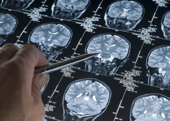 Βιταμίνη-d:-Υψηλά-επίπεδα-στη-μέση-ηλικία-συνδέονται-με-λιγότερη-πρωτεΐνη-tau-στον-εγκέφαλο-και-χαμηλότερο-κίνδυνο-Αλτσχάιμερ