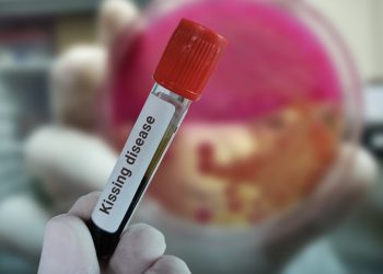 Σκλήρυνση-κατά-πλάκας:-Συνηθισμένη-λοίμωξη-των-νέων-τριπλασιάζει-τον-κίνδυνο