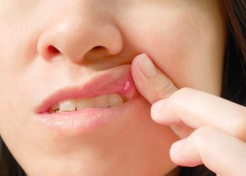 Τι-σημαίνουν-πραγματικά-οι-λευκές-κηλίδες-στο-στόμα-ή-στα-γεννητικά-όργανα